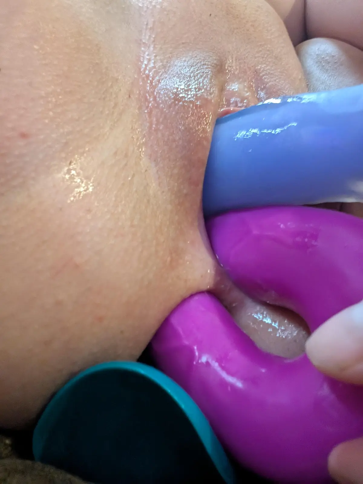 Preview image: DP preview 1